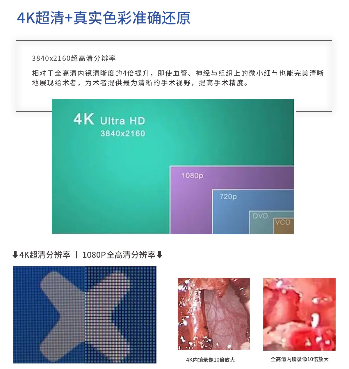 【4K醫(yī)用內(nèi)窺鏡攝像系統(tǒng)】您的第一臺“4K”找到了嗎？