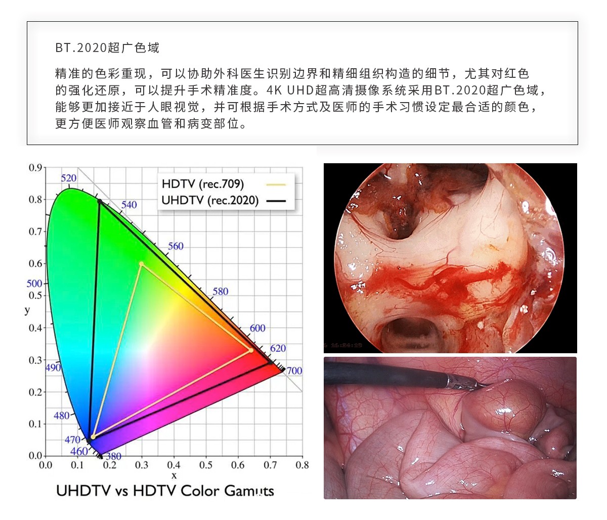 【4K醫(yī)用內(nèi)窺鏡攝像系統(tǒng)】您的第一臺“4K”找到了嗎？