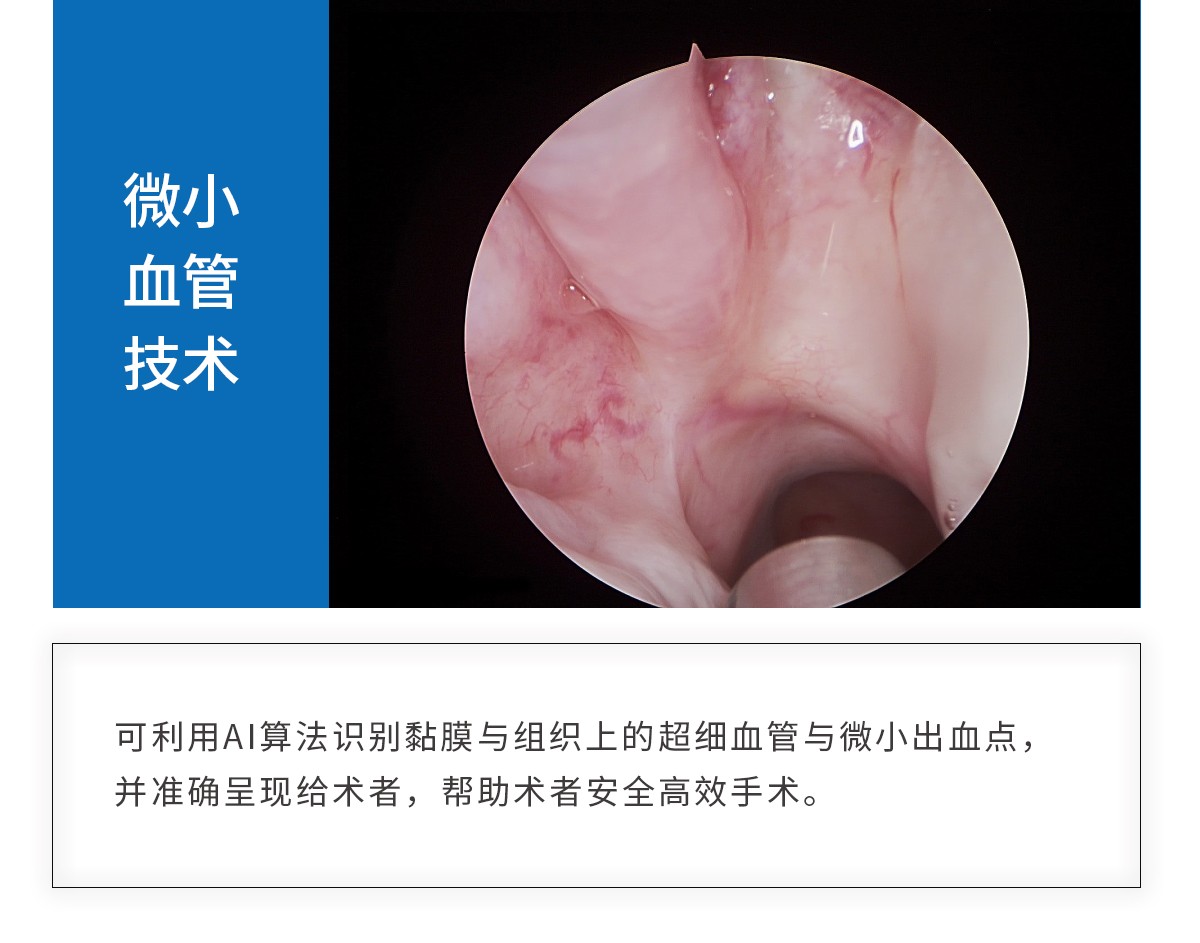 【4K醫(yī)用內(nèi)窺鏡攝像系統(tǒng)】您的第一臺“4K”找到了嗎？