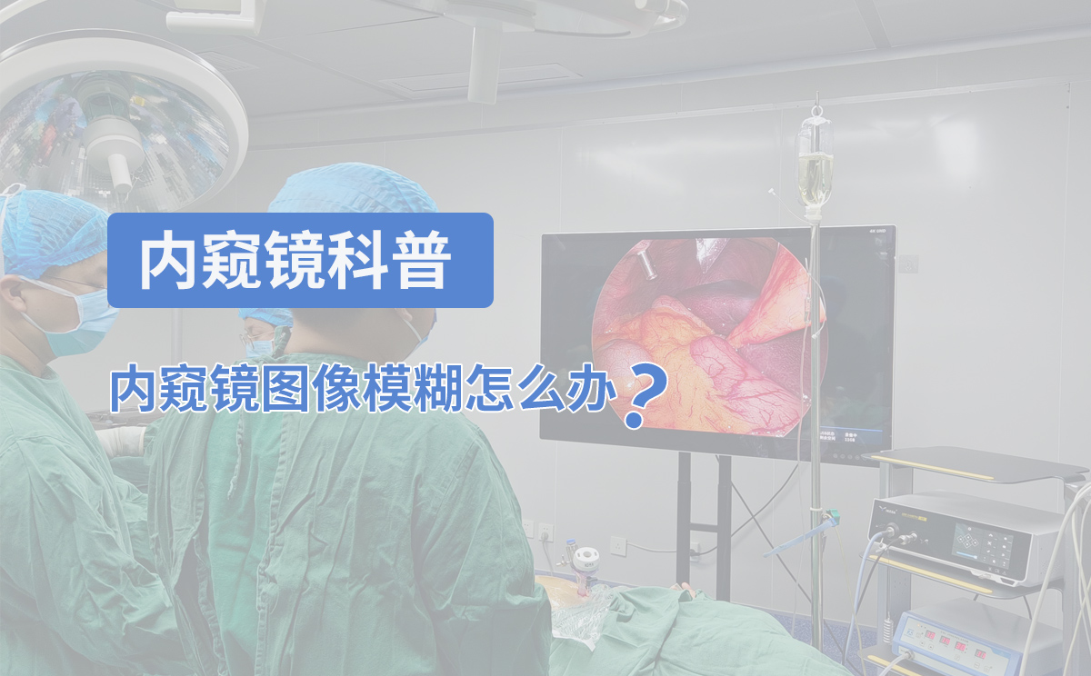 內(nèi)窺鏡科普：內(nèi)窺鏡圖像模糊怎么辦？
