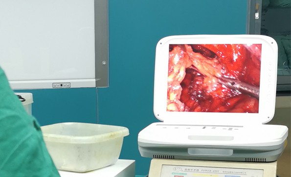 【腹腔鏡篇】腹腔鏡疝氣手術(shù)，您知道嗎？