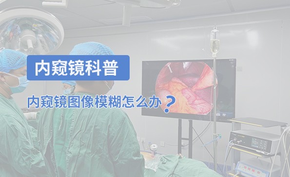 內(nèi)窺鏡科普：內(nèi)窺鏡圖像模糊怎么辦？